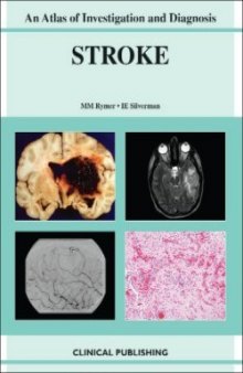 Ischemic Stroke: An Atlas of Investigation and Treatment (Atlases of Investigation and Management)