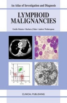 Lymphoid Malignancies: An Atlas of Investigation and Management