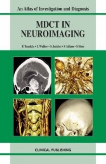 Multidetector CT in Neuroimaging: An Atlas and Practical Guide