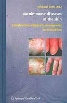 Autoimmune diseases of the skin : pathogenesis, diagnosis, management