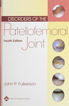 Disorders of the patellofemoral joint