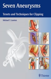 Seven Aneurysms: Tenets and Techniques for Clipping
