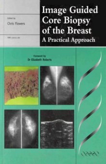 Image Guided Core Biopsy of the Breast: A Practical Approach