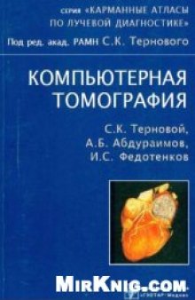 Компьютерная томография