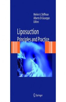 Shiffman Liposuction-Principles and Practice