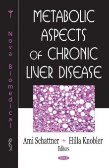 Metabolic Aspects of Chronic Liver Disease