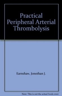 Practical Peripheral Arterial Thrombolysis