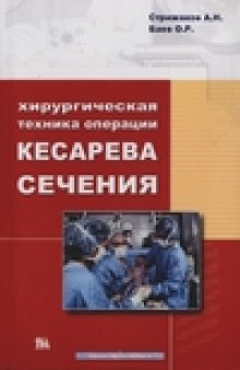 Хирургическая техника операции кесарева сечения