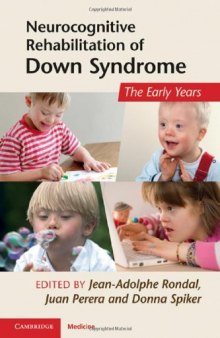 Neurocognitive Rehabilitation of Down Syndrome: Early Years