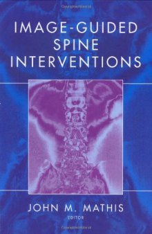 Image-Guided Spine Interventions