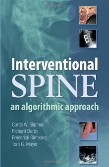Interventional Spine: An Algorithmic Approach  