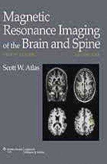 Magnetic resonance imaging of the brain and spine. 2