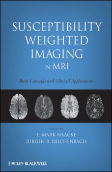 Susceptibility Weighted Imaging in MRI: Basic Concepts and Clinical Applications