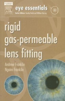 Eye Essentials: Rigid Gas-Permeable Lens Fitting, 1e