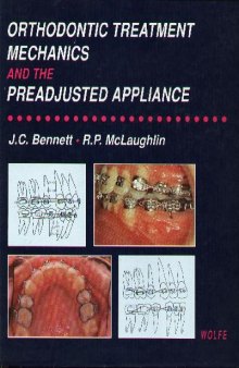 Orthodontic treatment mechanics and the preadjusted appliance