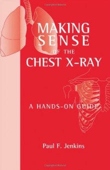 Making Sense of the Chest X-ray: A Hands-on Guide (Hodder Arnold Publication)