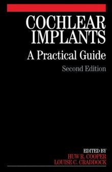 Cochlear Implants: A Practical Guide