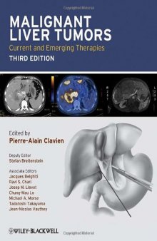 Malignant Liver Tumors, Third Edition: Current and Emerging Therapies