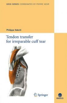 Tendon transfer for irreparable cuff tear (Collection GECO)  