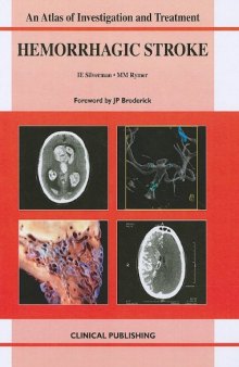 Hemorrhagic Stroke: An Atlas of Investigation and Treatment (Atlas of Assessment, Diagnosis and Management)
