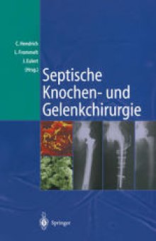 Septische Knochen-und Gelenkchirurgie