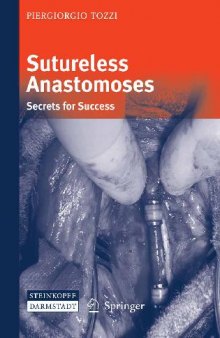 Sutureless Anastomoses: Secrets for Success