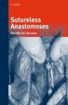 Sutureless anastomoses: Secrets for success