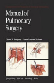 Manual of Pulmonary Surgery