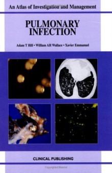 Pulmonary Infection: An Atlas of Investigation and Management