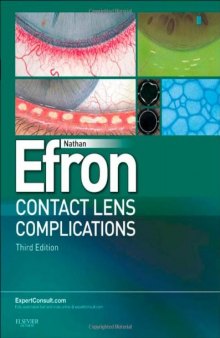 Contact Lens Complications