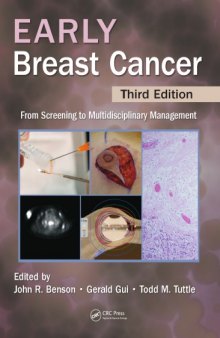 Early breast cancer : from screening to multidisciplinary management