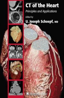 CT Chest Atlas