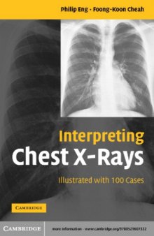 Interpreting chest x-rays : illustrated with 100 cases