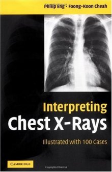 Interpreting Chest X-Rays Illustrated with 100 Cases