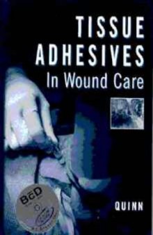 Tissue adhesives in wound care