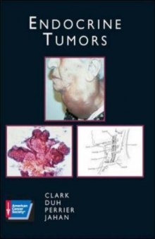 Endocrine Tumors (Atlas of Clinical Oncology)