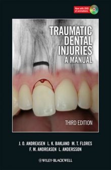 Traumatic Dental Injuries: A Manual