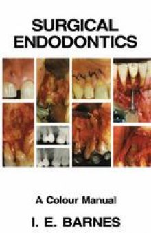 Surgical Endodontics: A Colour Manual
