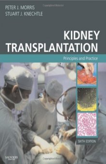 Kidney Transplantation: Principles and Practice, 6th Edition (Morris,Kidney Transplantation)  