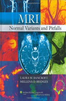 MRI Normal Variants and Pitfalls