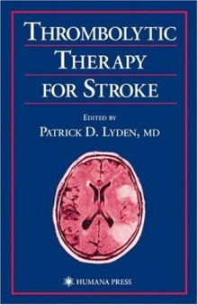 Thrombolytic Therapy for Stroke