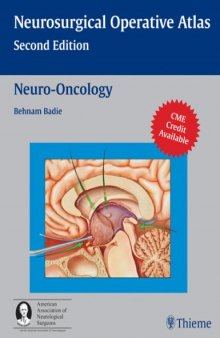 Neuro-Oncology - Neurosurgical Operative Atlas 2nd Edition