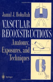 Vascular reconstructions: anatomy, exposures, and techniques