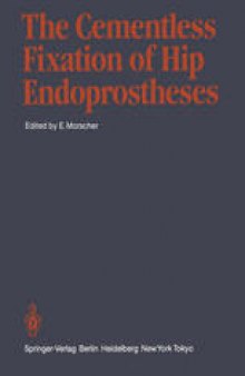 The Cementless Fixation of Hip Endoprostheses