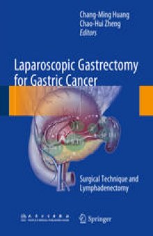 Laparoscopic Gastrectomy for Gastric Cancer: Surgical Technique and Lymphadenectomy
