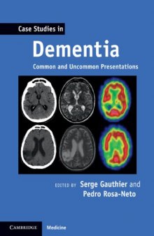 Case Studies in Dementia: Common and Uncommon Presentations (Case Studies in Neurology)  
