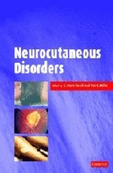 Neurocutaneous disorders