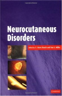 Neurocutaneous Disorders