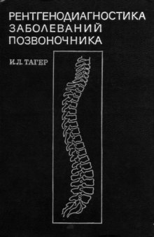Рентгенодиагностика заболеваний позвоночника