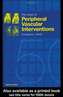 Fifty Cases of Peripheral Vascular Interventions
